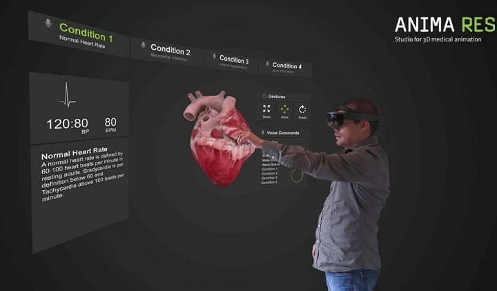 Додаток INSIGHT HEART HoloLens